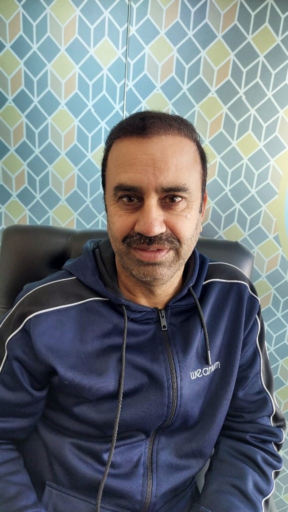 FUE Hair Transplant Result Islamabad