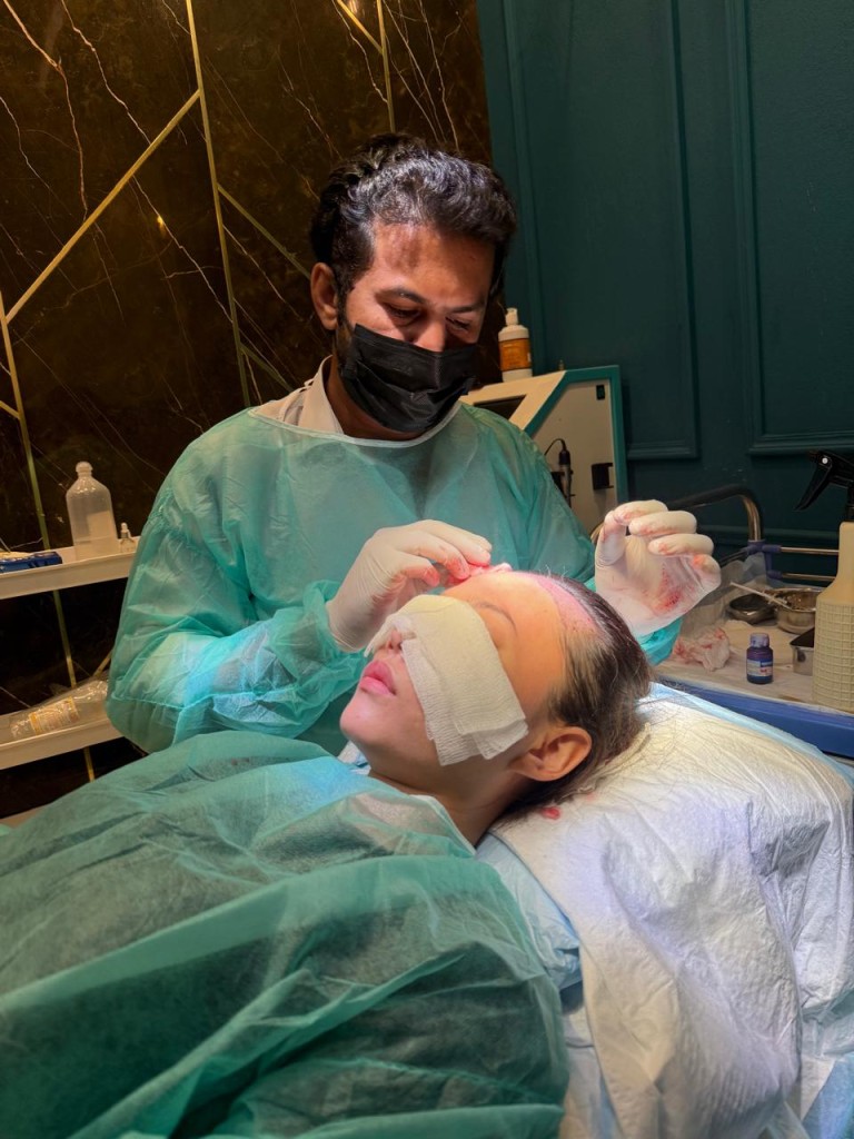 Best hair transplant in islamabad
