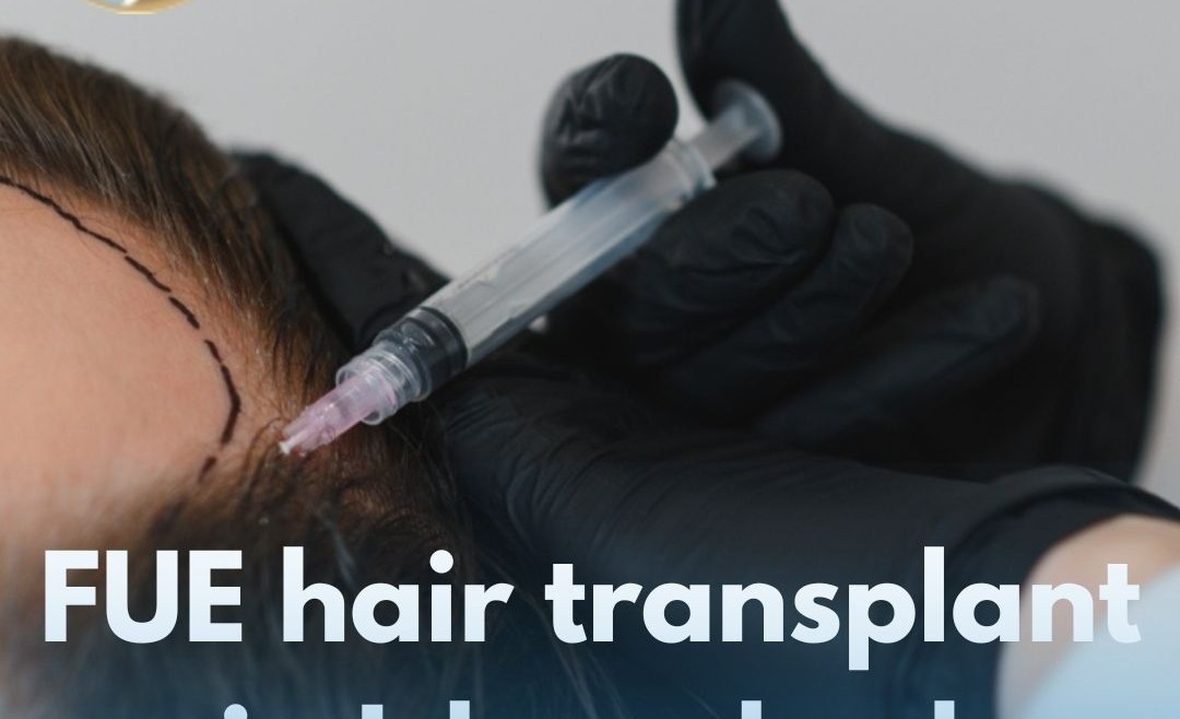 FUE Hair Transplant in Islamabad – Your Complete Guide