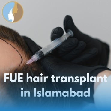 FUE Hair Transplant in Islamabad – Your Complete Guide
