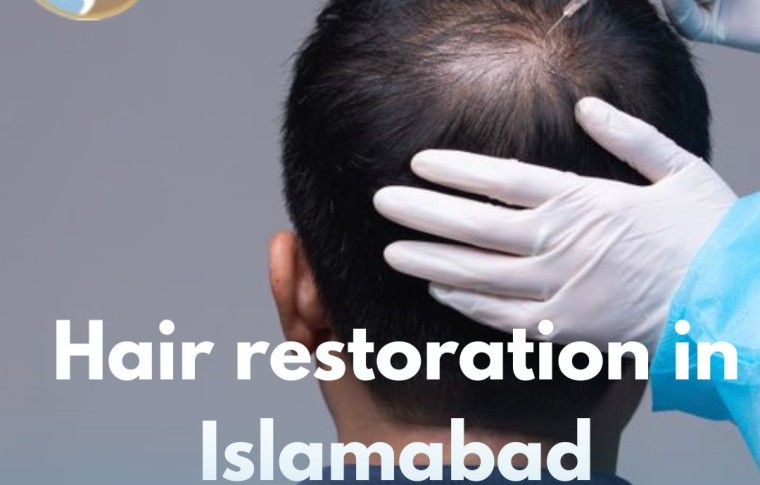 Hair Restoration in Islamabad – Your Guide to Natural Hair Restoration