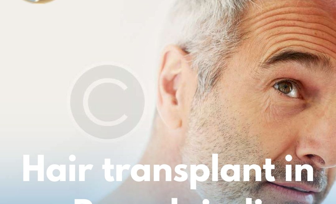 Hair Transplant in Rawalpindi – Your Complete Guide to Natural Hair Restoration