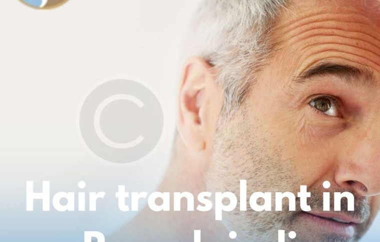 Hair Transplant in Rawalpindi – Your Complete Guide to Natural Hair Restoration