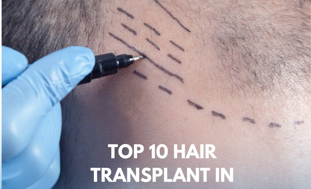 Top 10 Hair Transplant in Islamabad – Find the Best Clinics for You