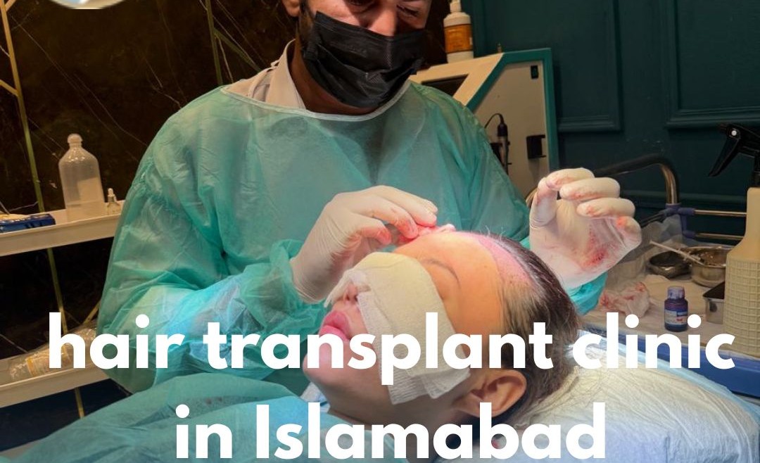 Hair Transplant Clinic in Islamabad– Your Trusted Choice for Hair Restoration