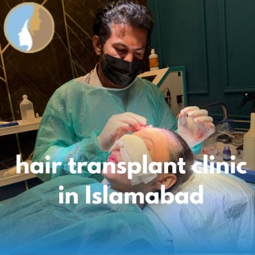 Hair Transplant Clinic in Islamabad– Your Trusted Choice for Hair Restoration