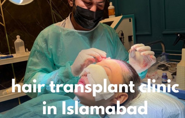 Hair Transplant Clinic in Islamabad– Your Trusted Choice for Hair Restoration