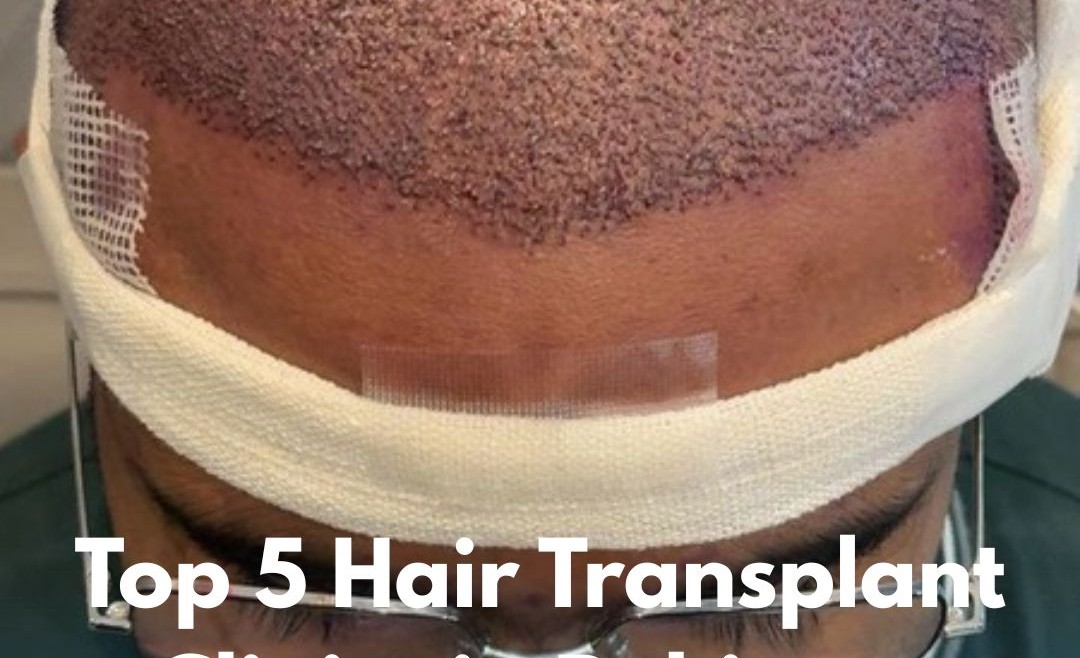 Top 5 Hair Transplant Clinics in Pakistan