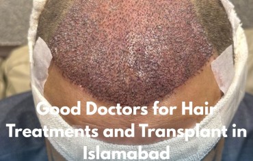 Good Doctors for Hair Treatments and Transplant in Islamabad