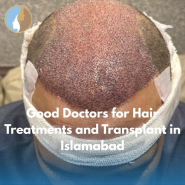 Good Doctors for Hair Treatments and Transplant in Islamabad